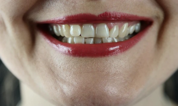 Teeth4 - جريدة الوفاق الالكترونية